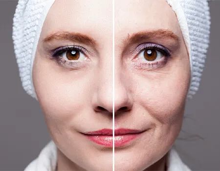 میکرودرم ابریژن: روشی موثر برای جوانسازی پوست