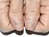 تغییر رنگ ناخن دست و پا: علل، علائم و راه های پیشگیری
