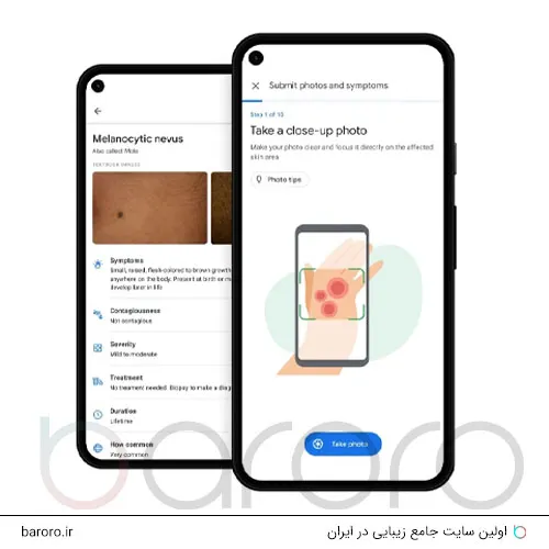 نحوه استفاده از گوگل لنز برای تشخیص بیماری پوستی