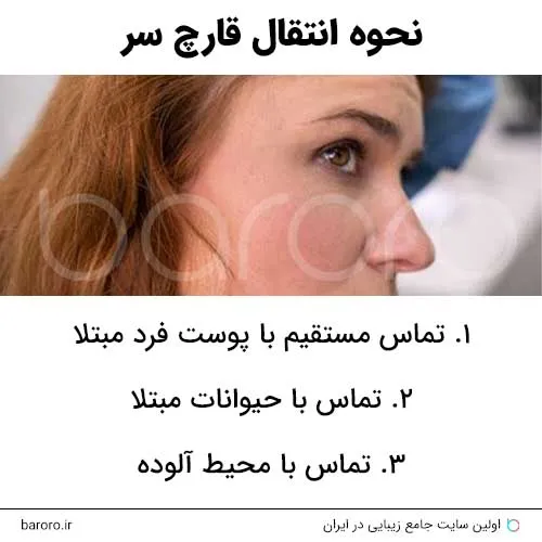 نحوه انتقال قارچ سر