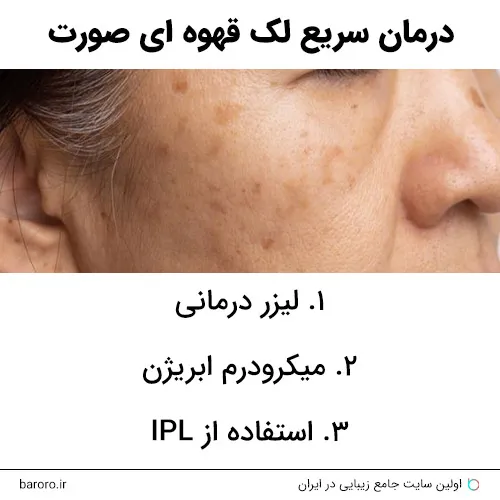 درمان سریع لک قهوه ای صورت