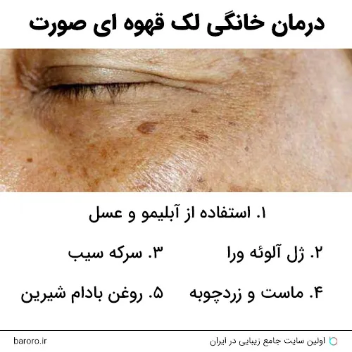 درمان خانگی لک قهوه ای صورت