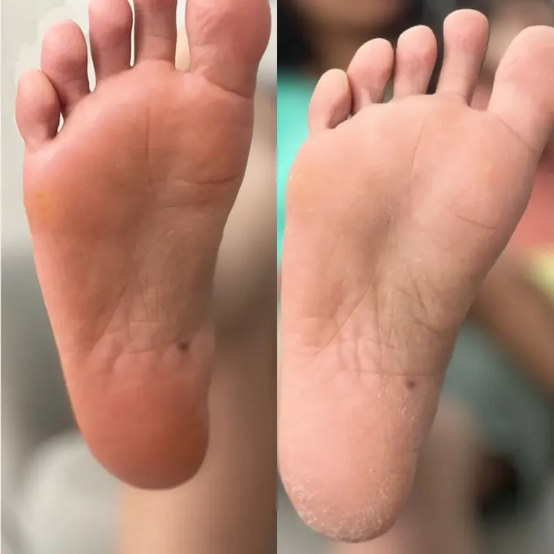 پدیکور تخخصی