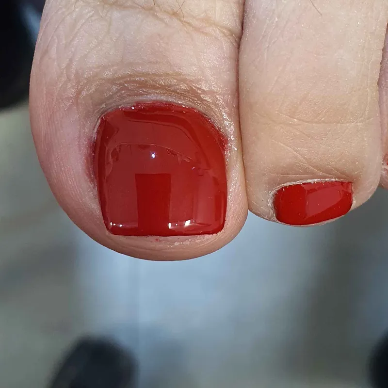 کاشت شست پا