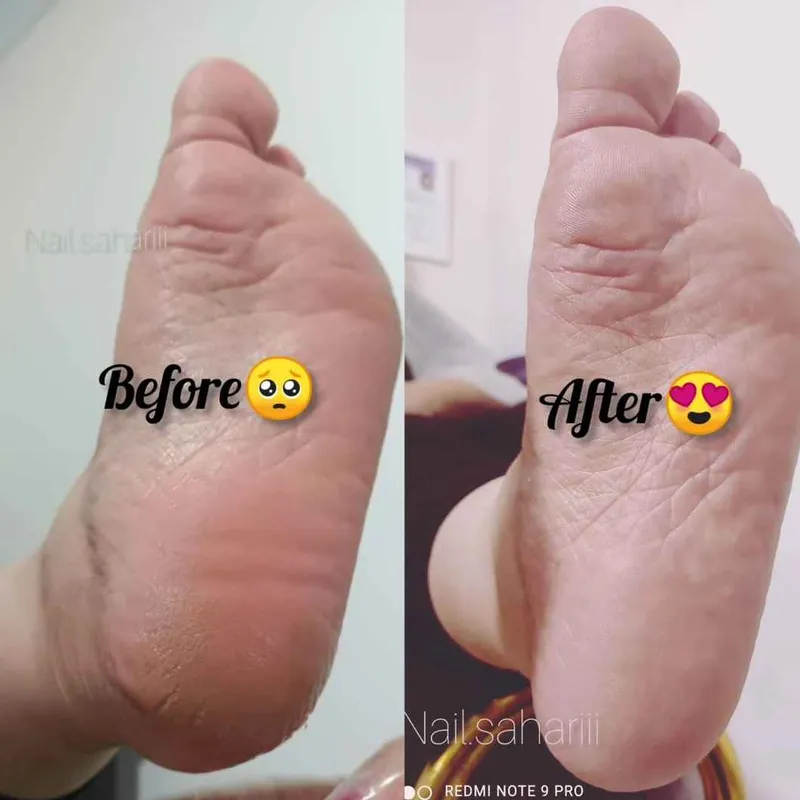 پدیکور کفسابی پا 