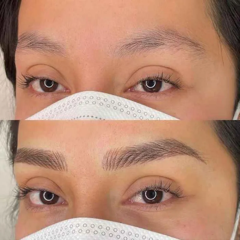 میکروبلیدینگ