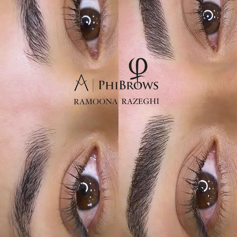 فیبروز ابرو 