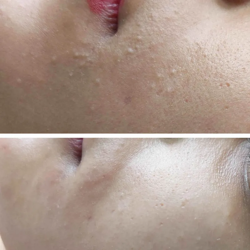 جوش و میلیا