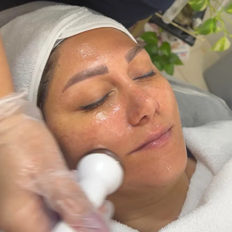 فیشیال تخصصی صورت 