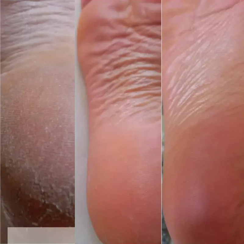 پدیکور درمانی