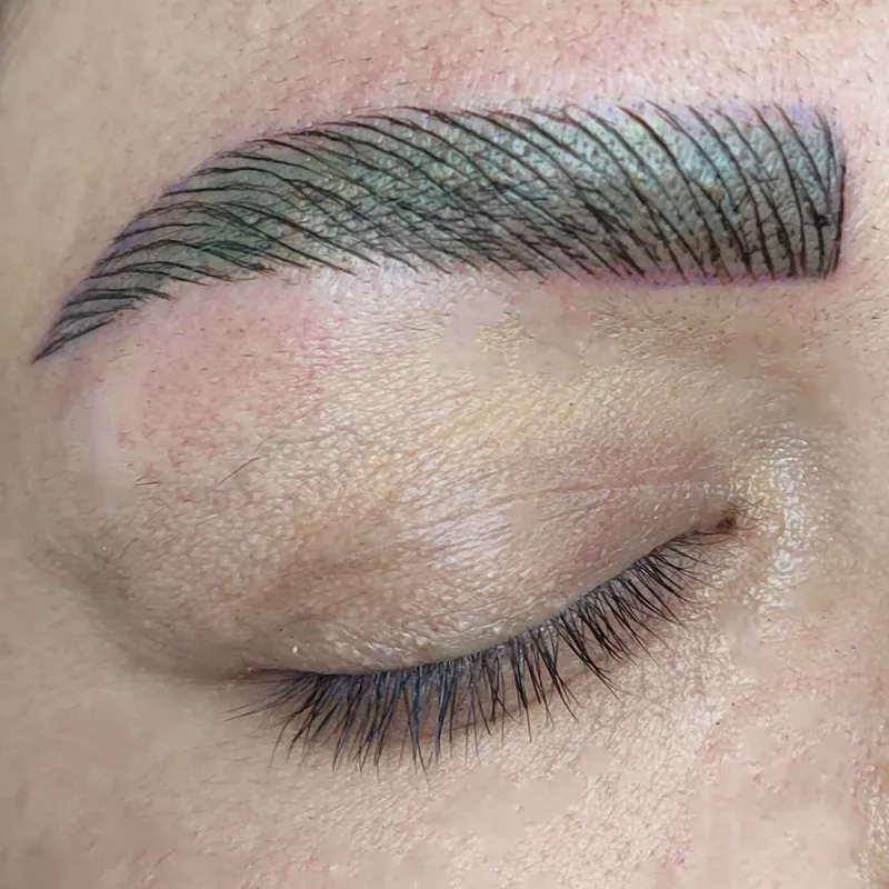 میکروبلیدینگ