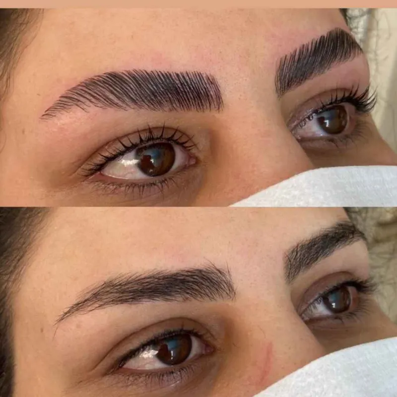 لیفت ابرو نچرال 