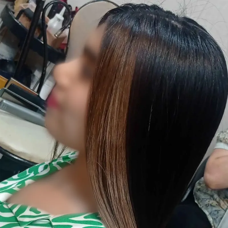 خاویار تراپی