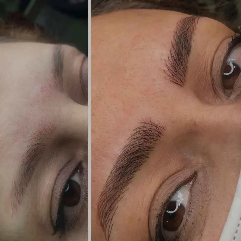 میکرو بلدینگ و فیبروز و هاشور کرکی و مویی