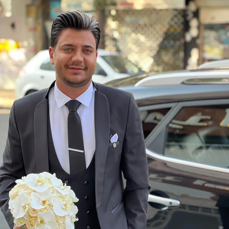 قبل و بعد داماد