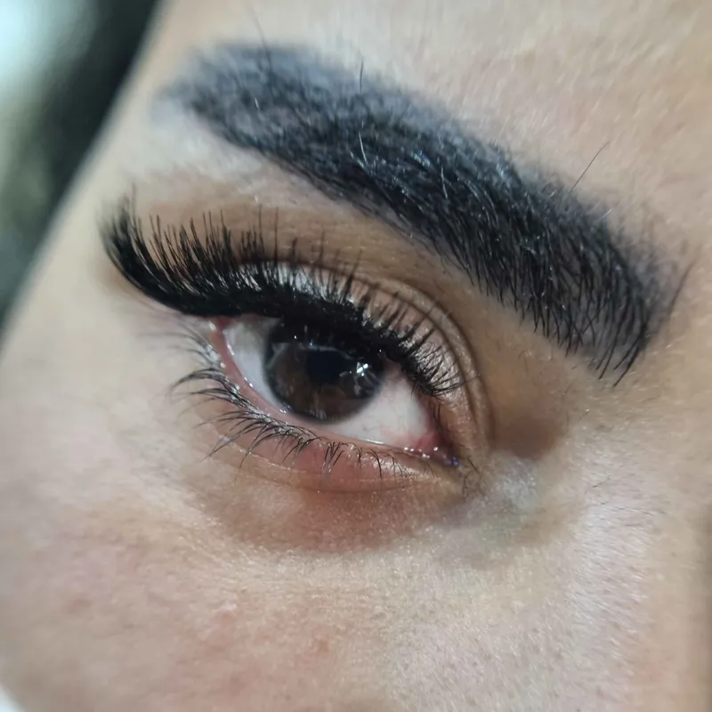 کاشت مژه نیمه گربه ای