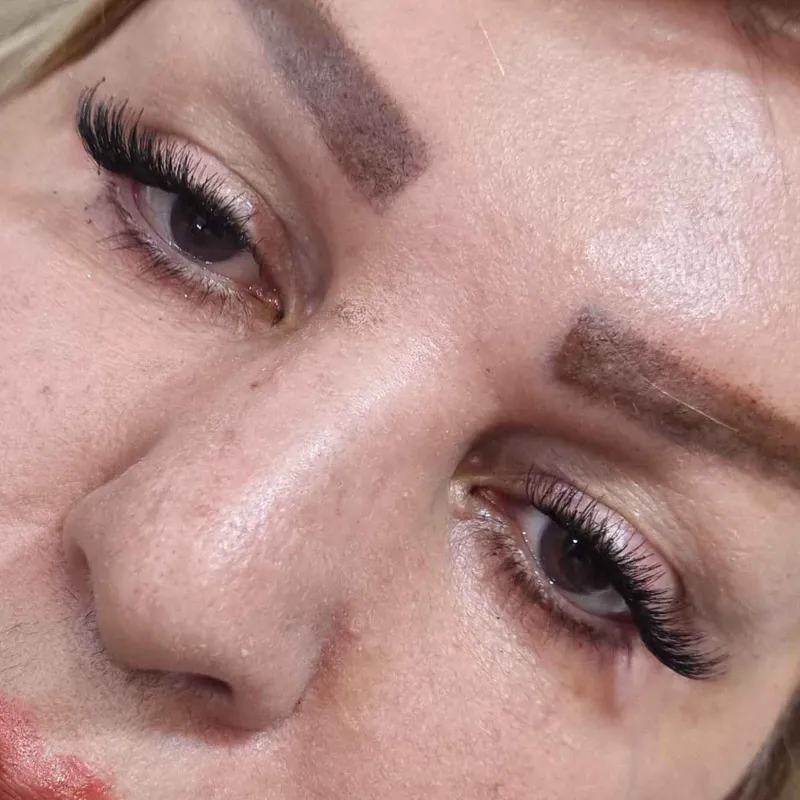 کاشت مژه گربه ای