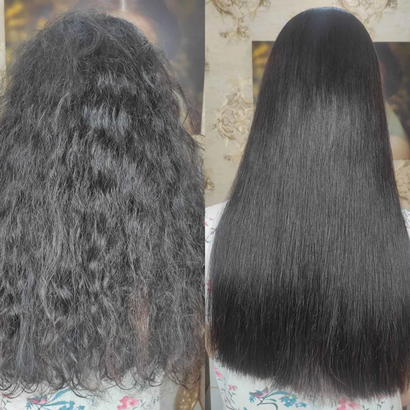 هیدروتین تراپی