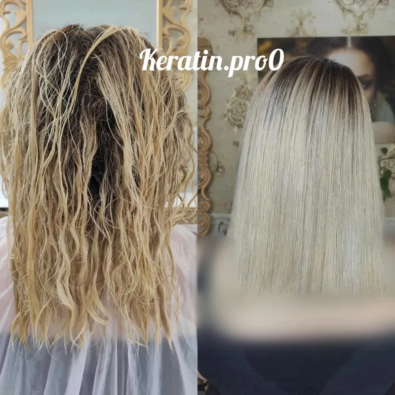 تکنیک اوکسی پلاستیا