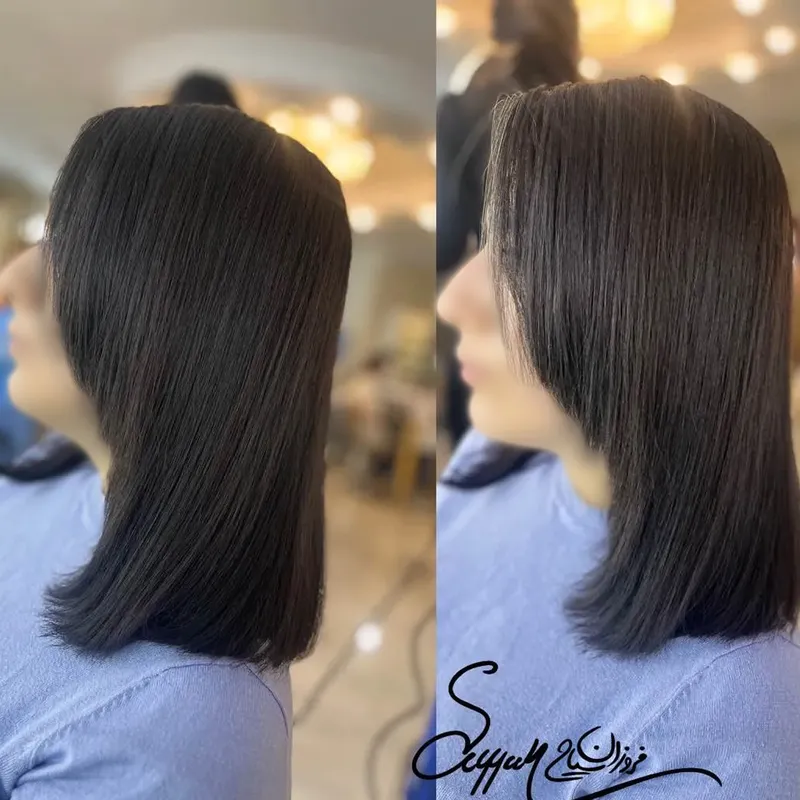 پروتیینه تراپی