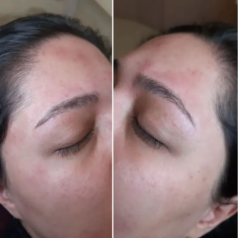 اصلاح و قرینه سازی ابرو