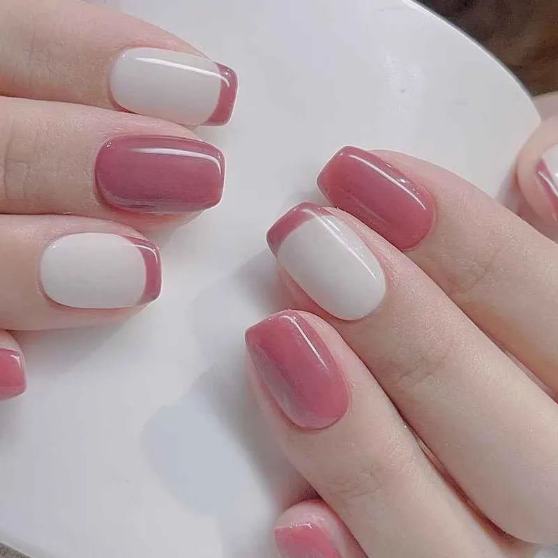 کاشت پلی ژل 