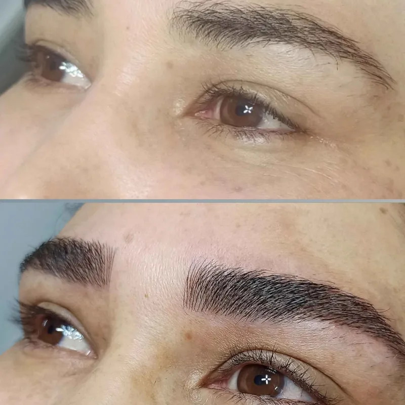 میکروبلیدینگ کرکی مویی