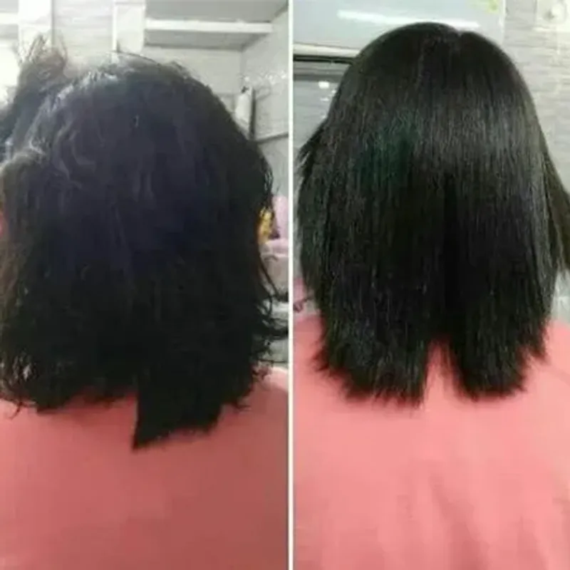 پروتئین تراپی