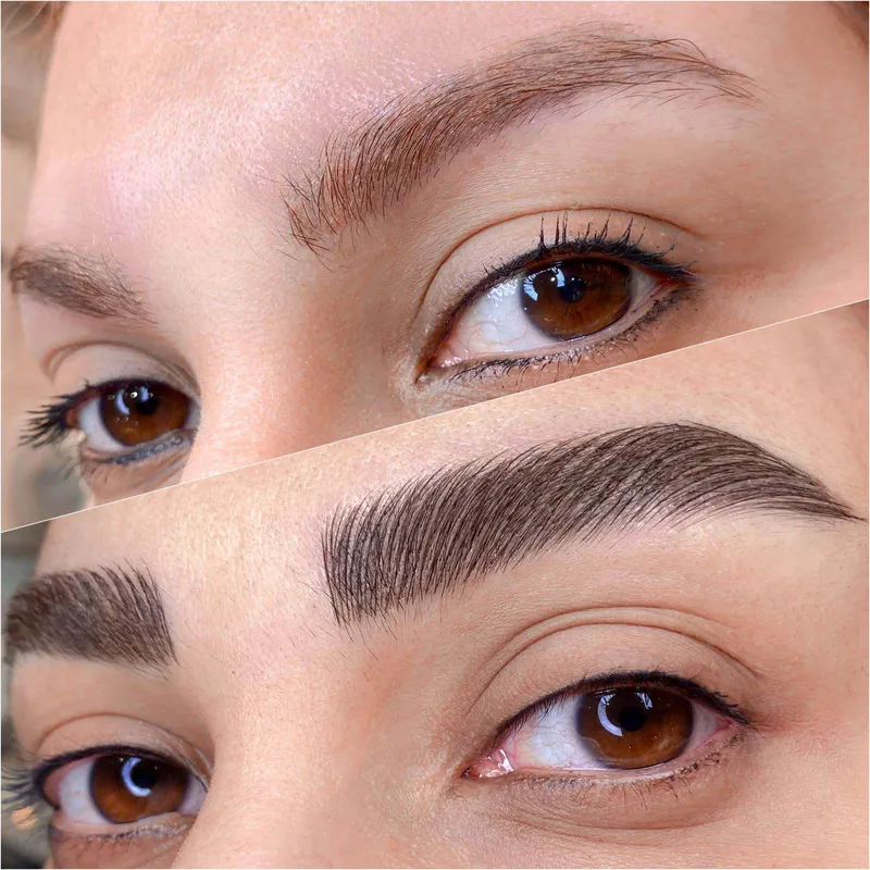 میکروبلیدینگ