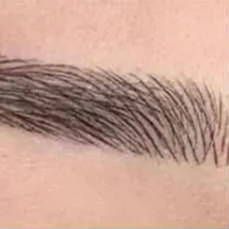 میکروبلیدینگ