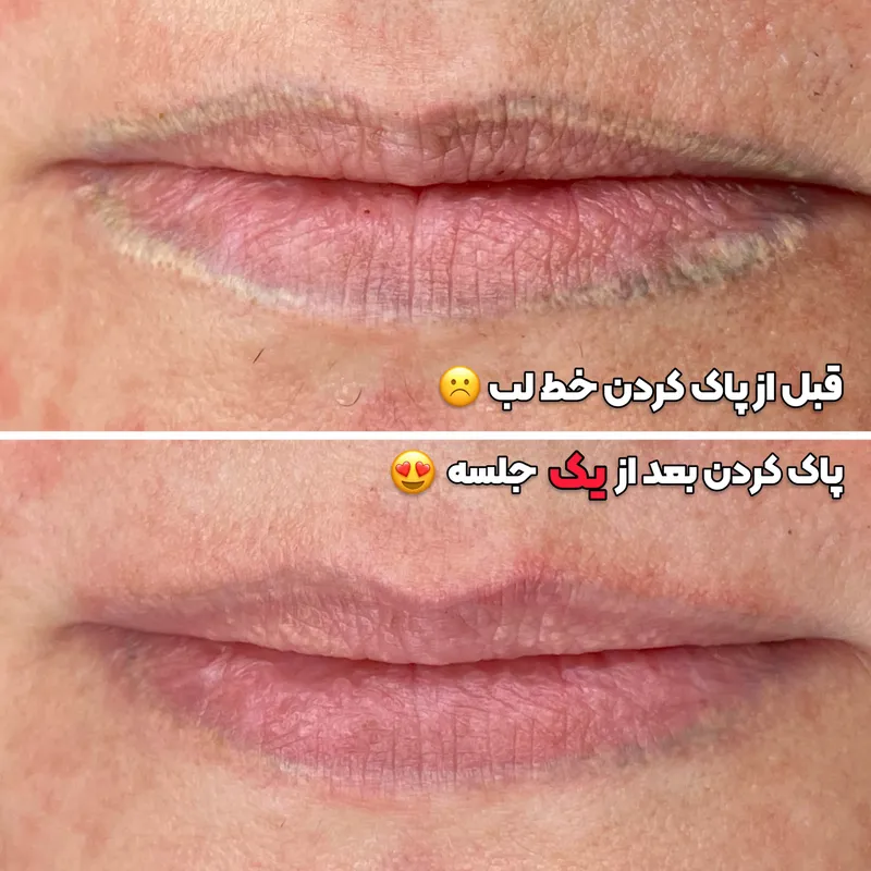 پاک کردن خط لب 