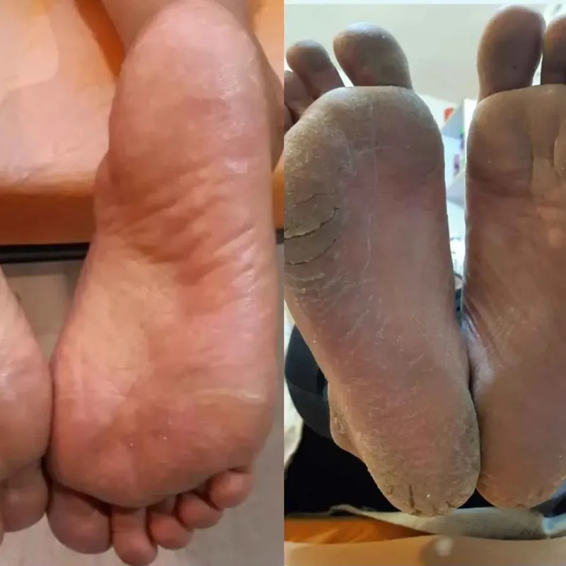 پدیکور و پارافین تراپی پا