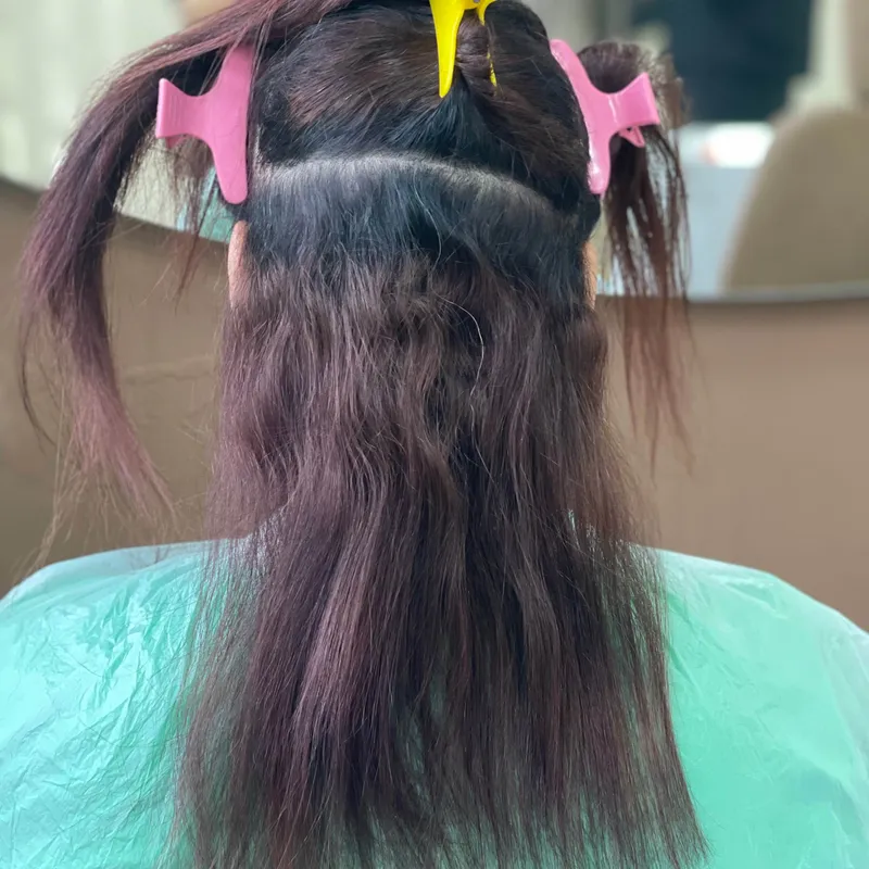 رشد ریشه بوتاکس