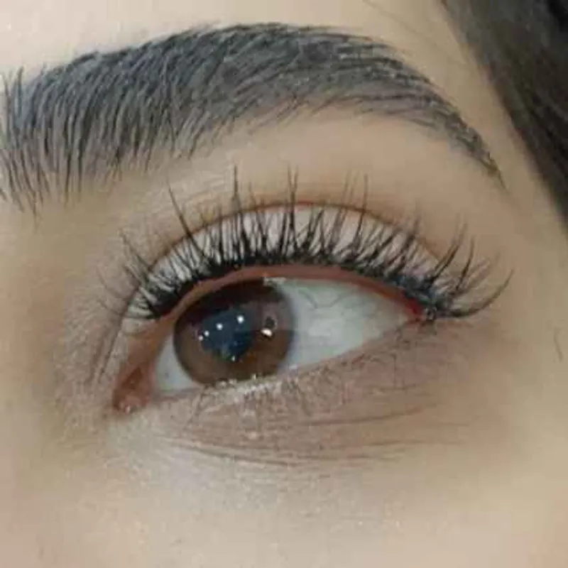کاشت مژه موقت 