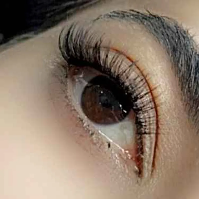 کاشت مژه موقت