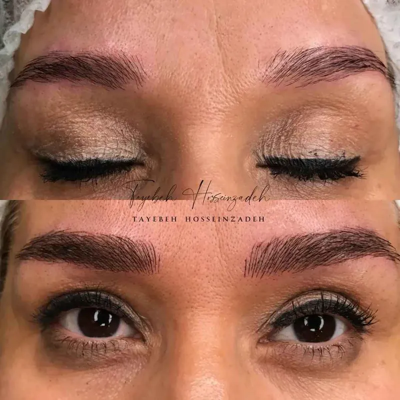 فیبروز ابرو