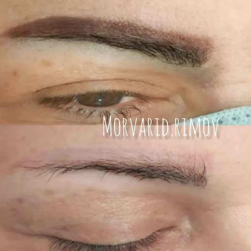 ریمو تک جلسه ای 