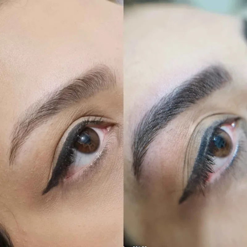 فیبروز ابرو 