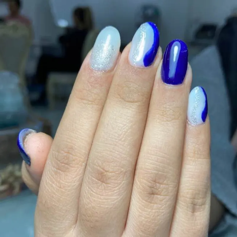 ترمیم ژل