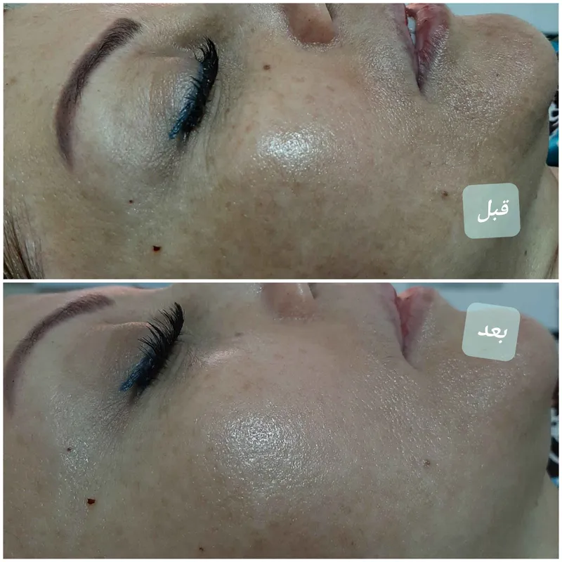 فیشال تخصصی