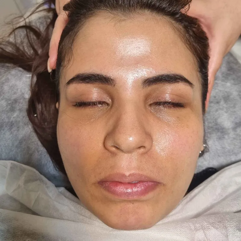 فشیال صورت 
