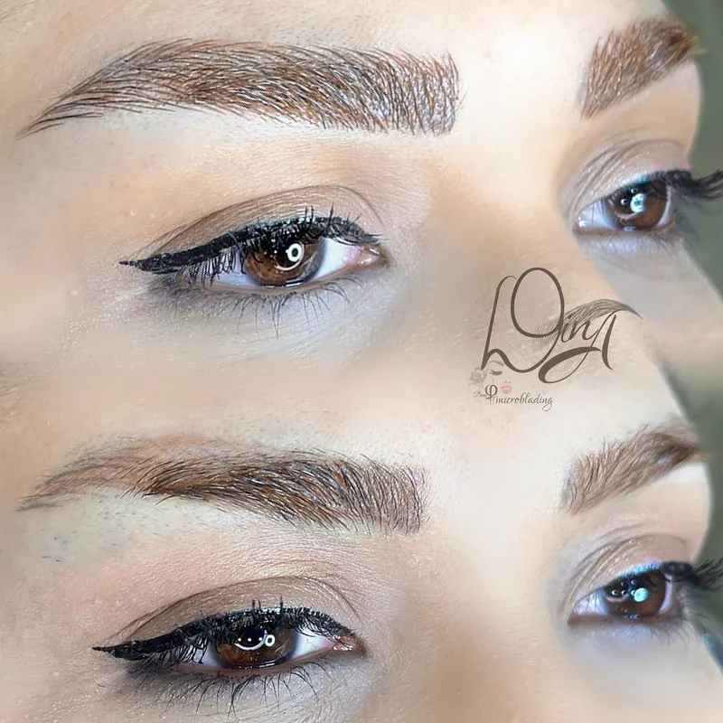 فیبروز میکروبلیدینگ