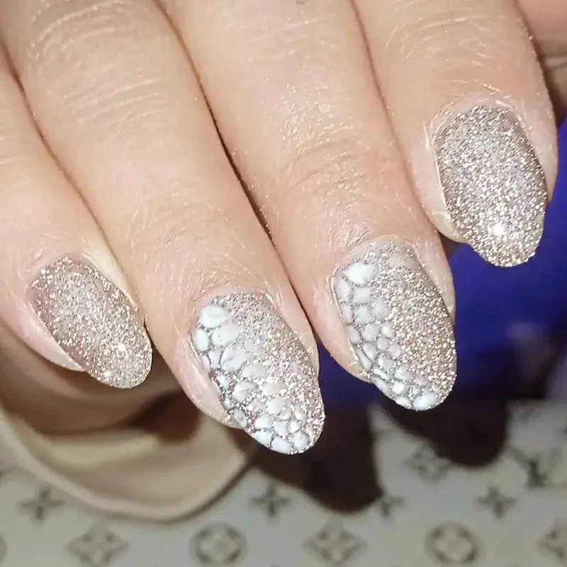 ترمیم لمینت