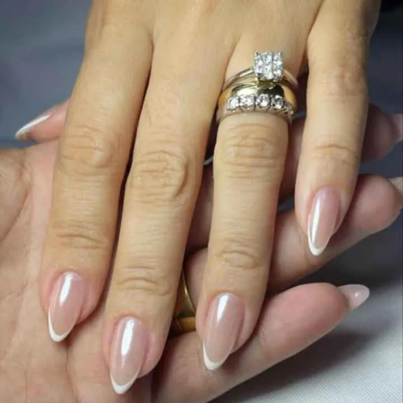 کاشت ژل 