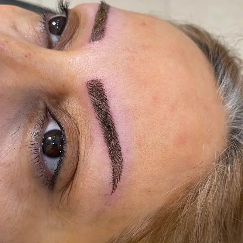 میکروبلیدینگ