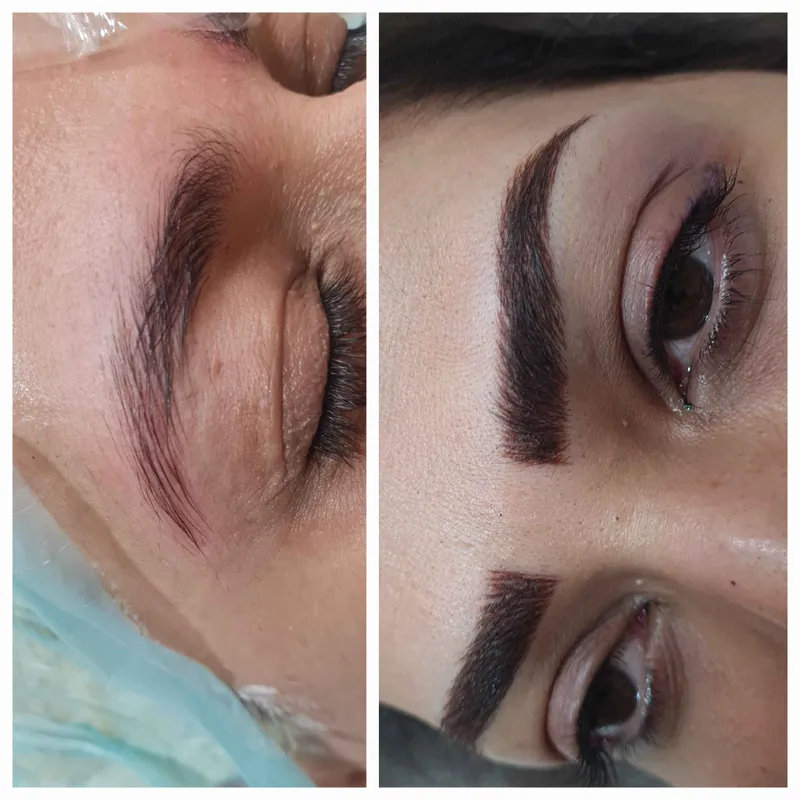 خدمات تخصصی فیبروز ابرو