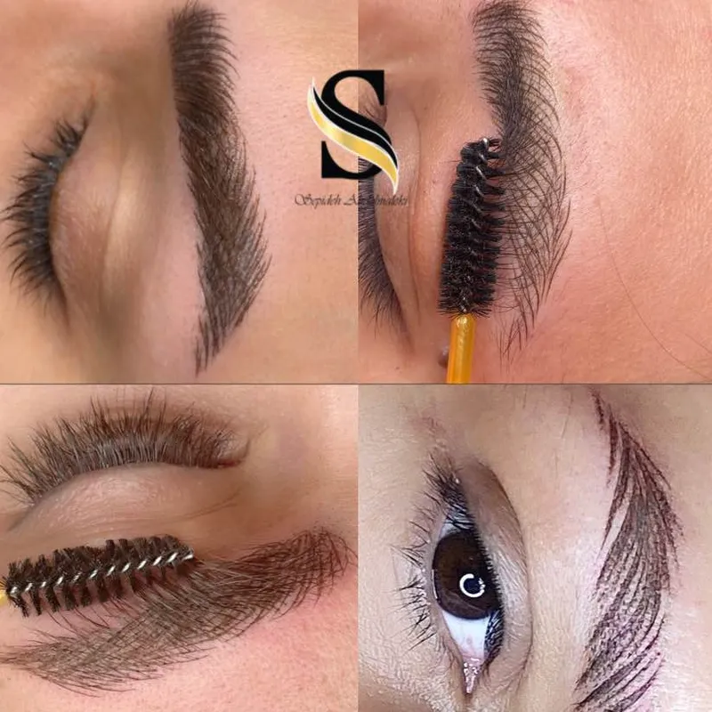 میکروبلیدینگ