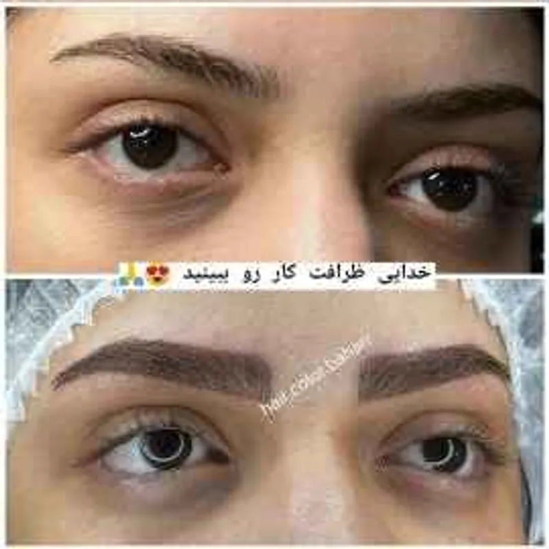 فیبروز  ابرو 