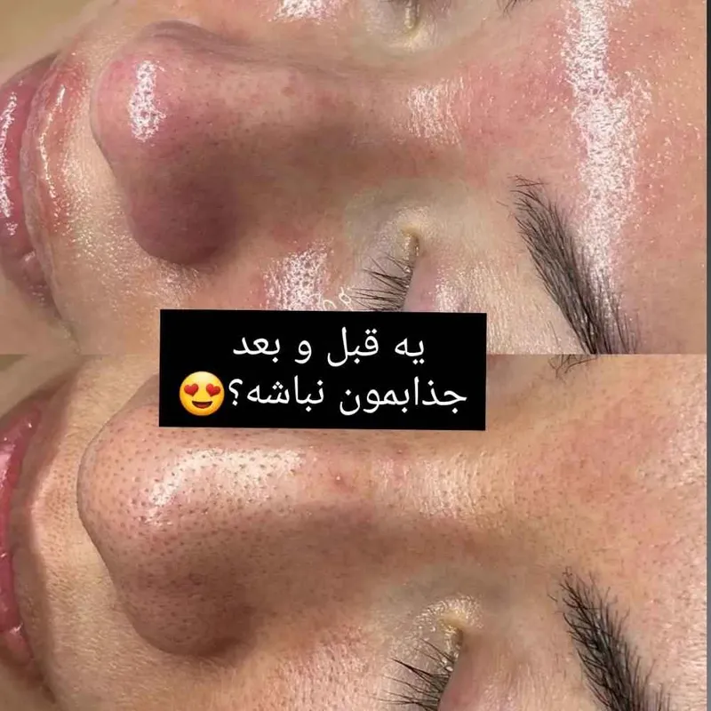 فیشال
