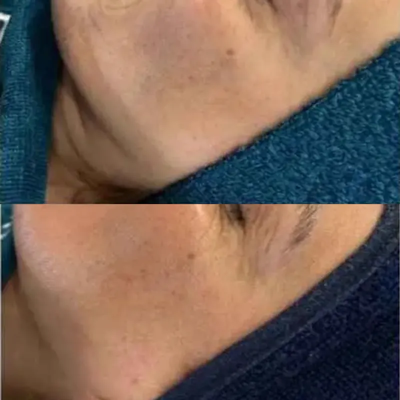 قبل و بعد از پاکسازی